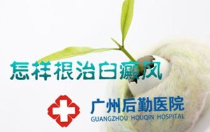 白癜风患者怎样对症治疗