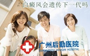 广州那家白癜风医院好 广州那家白癜风医院好
