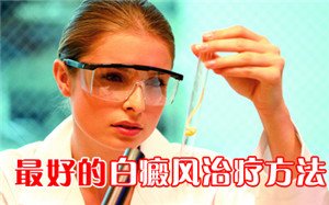 得了白癜风怎样治疗好 得了白癜风怎样治疗好