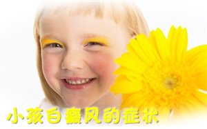 小儿白癜风怎样治疗 小儿白癜风怎样治疗