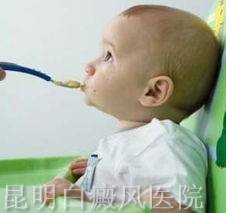 儿童白癜风病因