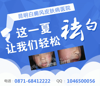 临沧治疗白癜风哪家医院好