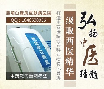 昆明治疗白癜风的医院