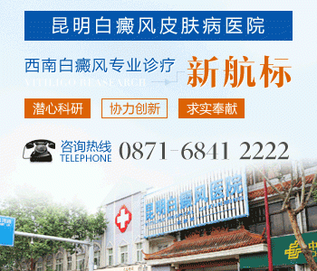 昆明哪里治疗白癜风较好