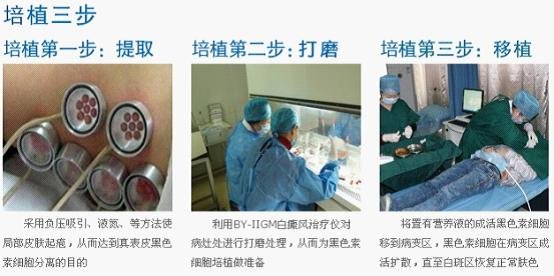 雷鸣 住院部主任