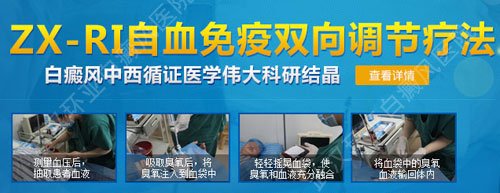 楚天金报:白癜风医院哪家好