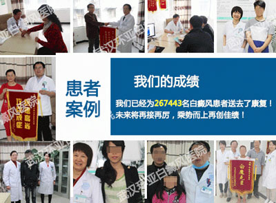 2014夏季白癜风诊疗大型优惠活动盛大启动