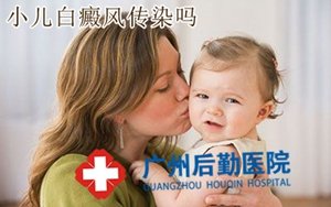 白癜风会传染吗