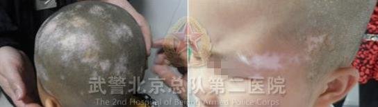 ����ʱ��С��ͷ���װ����ԣ��߽�ģ��