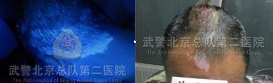 (老郑头部白斑明显,边界模糊 (老郑头部白斑明显,边界模糊