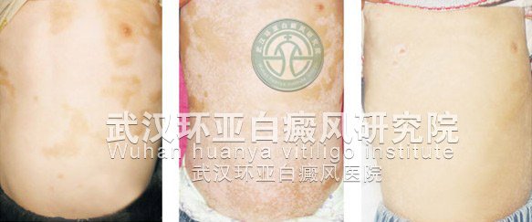 拯救濒临破碎的婚姻