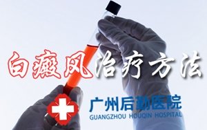 常见的白癜风治疗方法