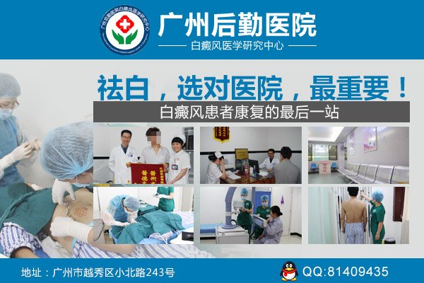 广州白癜风哪里治疗