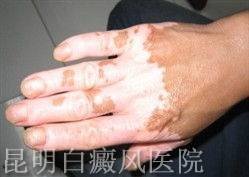 ôʹð粻ᱻɢ