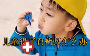 广州哪看白癜风好 广州哪看白癜风好