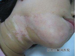 ô沿