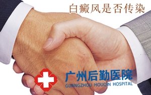 广州白癜风哪里治得好 广州白癜风哪里治得好