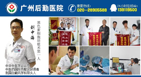 广州治疗白癜风的医院在哪里 广州治疗白癜风的医院在哪里