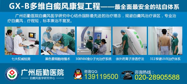 广州看白癜风的医院 广州看白癜风的医院