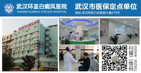 武汉环亚白癜风医院