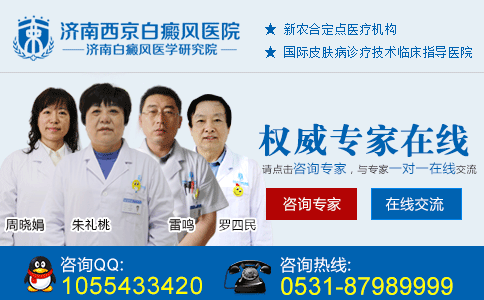 济南的医保定点白癜风医院 济南的医保定点白癜风医院
