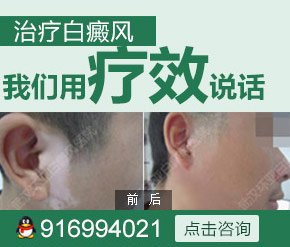 武汉市治疗白癜风的医院