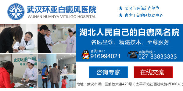 武汉治疗白癜风那好